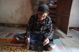 Sebatang Kara, Nenek Sarjinah Relakan Kanker Kulit Gerogoti Matanya