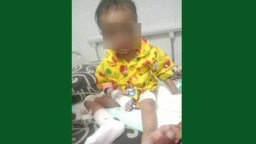 Balita di Kota Batu Dianiaya Calon Ayah Tiri, Disiksa hingga Disiram Air Panas