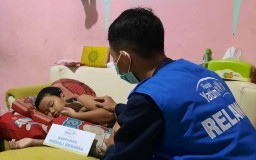 Tolong! Bocah di Surabaya Menderita Tumor Mata Stadium Akhir Butuh Bantuan