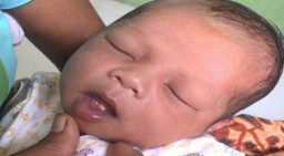 Fenomena Bayi Baru Lahir Sudah Tumbuh Gigi, Ini Kata Pakar