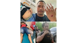 4 Polisi Terluka Dilempar Bom Bondet saat Gerebek DPO Kejahatan di Pasuruan