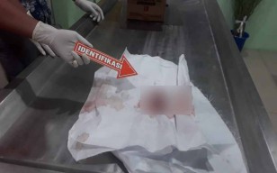 Hendak Pilah Sampah, Warga Sukodono Sidoarjo Temukan Janin Bayi di Sungai