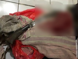 Digorok Anaknya Saat Tidur, Ibu di Jember Jalani Operasi
