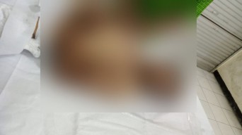 Huruf Hijaiyah Tewas Tersengat Listrik Saat Pasang Papan Reklame di Pasuruan