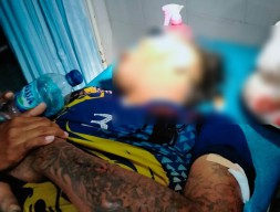 Warga Kabuh Jombang Korban Kebrutalan Oknum Pesilat Dirawat di RSUD Ngimbang