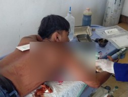 Siswa SMK di Mojokerto Dibacok Orang Misterius