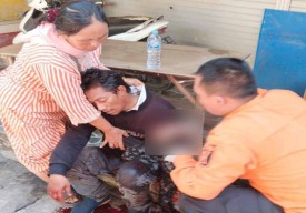 Diduga Rebutan Stand, Tangan Pria di Surabaya Nyaris Putus Dibacok Saudara