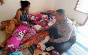 Nyalakan Lampu Spirtus, Wajah Siswi Terbakar saat Perkemahan di Sumenep