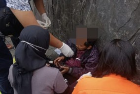 Pemotor Tabrak Mobil hingga Kepalanya Sobek, Gegara Melamun?
