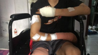 Belasan Gangster Bersajam Keroyok Pemuda asal Sidoarjo