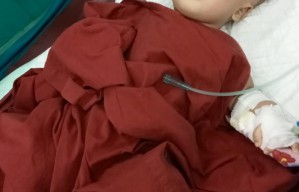 Kondisi Bayi Hidrosefalus asal Lamongan Dikabarkan Memburuk