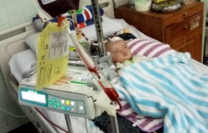Bayi Pengidap Hidrosefalus asal Lamongan, Tubuhnya Dipenuhi Jahitan dan Selang
