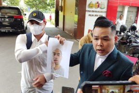 Ferry Irawan Curhat Dicakar Venna Melinda hingga Bibirnya Berdarah