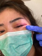 Keponakan Hotman Paris Hutapea Korban KDRT Suami di Mojokerto