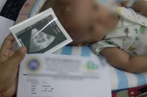 Kondisi Terkini Bayi Hidrosefalus di Lamongan Usai 6 Kali Operasi