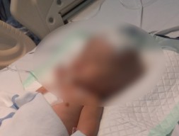 Donasi Bayi Hidrosefalus asal Lamongan Tembus Rp200 Juta, Orang Tua Sedih