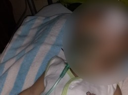 Bayi Hidrosefalus asal Lamongan, Konsumsi Obat Kejang Seumur Hidup