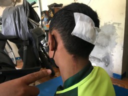Gangster di Sidoarjo Kembali Berulah, Hajar Pemuda Hingga Kepala Bocor