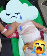 Begini Kisah Dokter IGD RSUD dr Harjono Ponorogo Tangani Anak Tercebur Kuah Panas