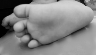 Diduga Malpraktik SKH, Tumit Bayi di Sumenep Menghitam Lalu Meninggal