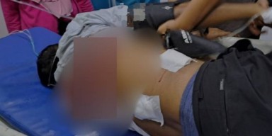 Korban Penembakan di Sampang adalah Relawan Prabowo-Gibran