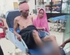 Anak di Bangkalan Aniaya Pria yang Lecehkan Ibunya Saat Memijat