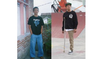Pria Asal Malang Tetap Semangat Breakdance Walau Hanya Berkaki 1, Luar Biasa..