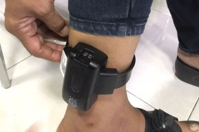 Tahanan Perempuan di Tulungagung Ini Dipasangi Alat Pengawas Elektronik