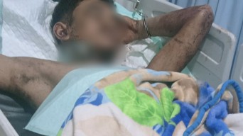 Anak Bunuh Bapak di Jember Jalani Operasi usai Gorok Lehernya Sendiri