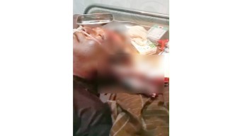 Warga Pamekasan Dilarikan ke RS gegara Tertusuk Moncong Ikan Marlin
