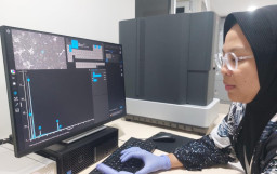 Studi Ecoton dan ITB, Nanoplastik Picu Kerusakan Sel dan Risiko Stroke Kronis
