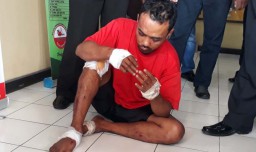 Ini Tampang Bandit Penjambret Wanita di Surabaya Hingga Tewas