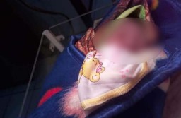 Pembuang Bayi dengan Luka Cekik di Malang itu Mahasiswi Kebidanan