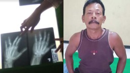Rebutan Warisan, Pria di Ponorogo Ini Tega Pukul Adiknya Pakai Martil