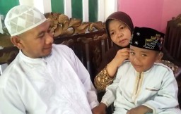 Mengenal Fajrin, Bocah Bermata Biru asal Pasuruan