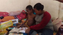 Viral, Bocah di Surabaya Diduga Mengidap Gizi Buruk 
