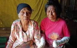 Gadis Kanibal asal Kediri Disebut Idap Skizofrenia