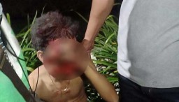 Terjatuh dari Motor, Seorang Jambret di Surabaya Babak Belur Dimassa
