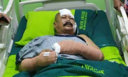 Luka Sayat di Pipi Aiptu Agus Membuat Korban Sulit Berkomunikasi