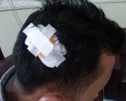 Ini Pengakuan Bripka DV yang Diduga Mesum dengan Bidan di Pasuruan