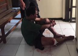Curi Motor, Pria asal Malang Dihajar Massa dan Ditembak Polisi