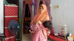 Derita Gangguan Metabolik, Balita di Pasuruan ini Butuh Uluran Tangan