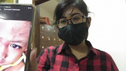 Nyaris Dijambret, Jurnalis Perempuan di Surabaya Terluka