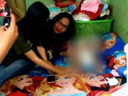 Bayi 5 Bulan di Surabaya Derita Hidrosefalus, Ini Langkah Pemkot