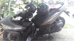 Ditendang Jambret, Cewek Cantik ini Luka Parah