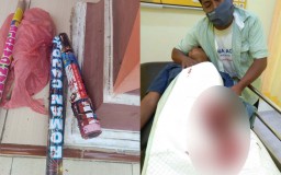 Tangan Pria di Pasuruan Hancur Terkena Ledakan Kembang Api