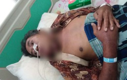 Tolong! Tuna Wisma Penderita Kanker di Lamongan ini Butuh Bantuan