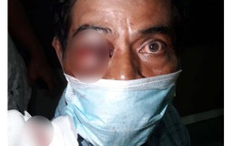 Gegara Gerobak, Penggali Kubur di Surabaya Dianiaya Teman Sendiri