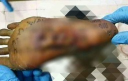 Tato di Telapak Kaki Korban Mutilasi Pasar Besar Malang Jadi Petunjuk?