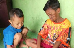 Tak Dendam Disiram Air Keras  Ayah Tirinya, Samuel Enggan Bertemu